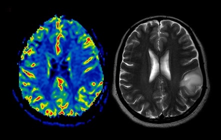Brain MRI scan image